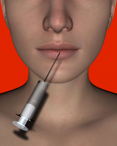 Call for regulation of dermal fillers, botox and other aesthetic products 